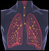 Lunge mit Flugzeug-Schadstoffen